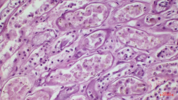 Digital pathology & biotechnology